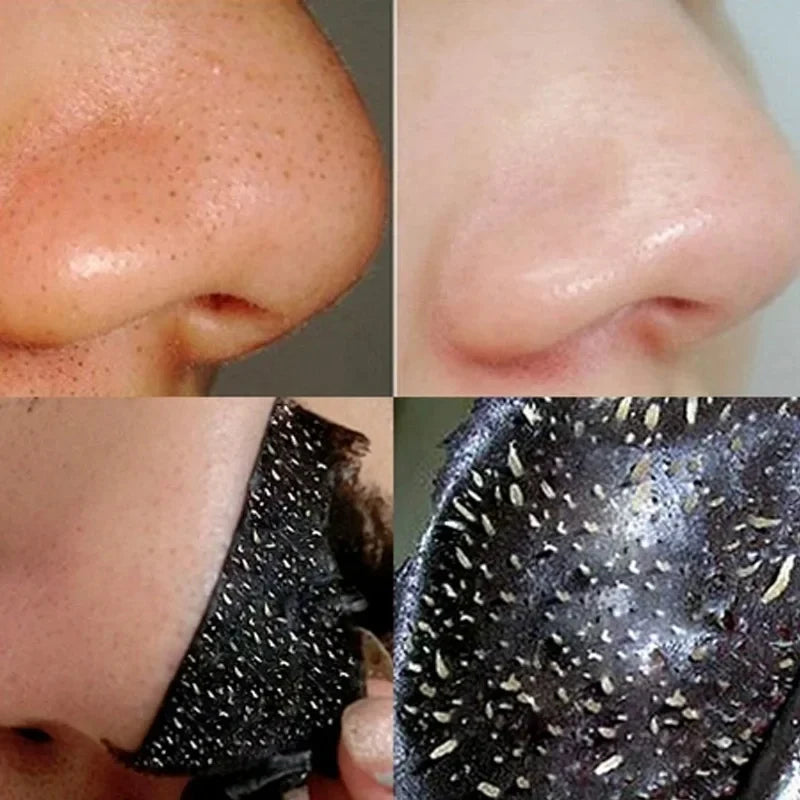 Máscara Removedor de Cravo Facial Psiquiatra Poros Acne Creme de Remoção de Cabeça Preta Limpeza do Nariz Preto Peel Off Máscaras Gel Cuidados com a Pele 20g